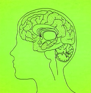 Brain with Alzheimer's disease